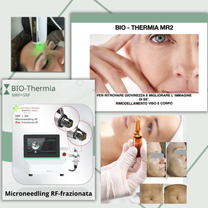 MCCM_microneedling